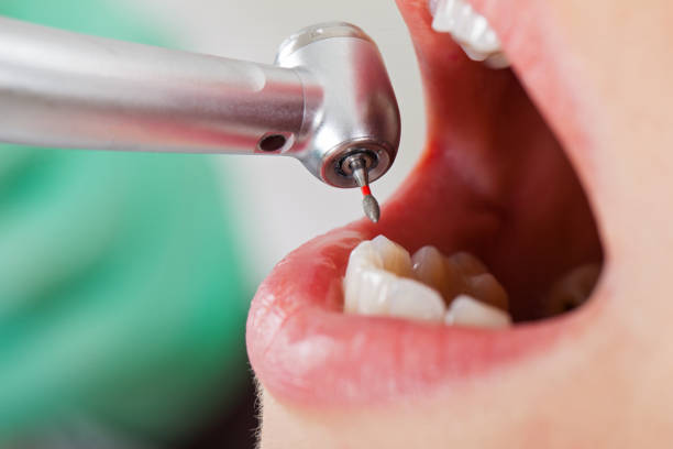 Best Emergency Treatment for Toothache in Clarks Green, PA